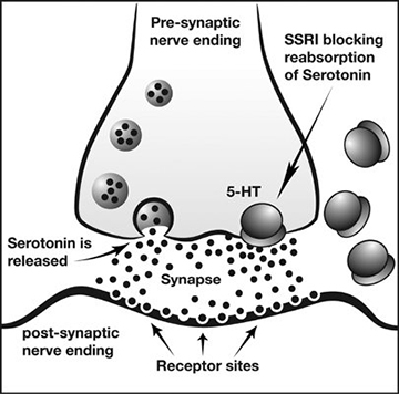 overemethylation.therapy